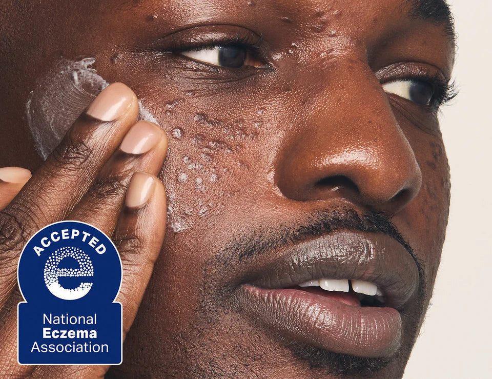 Prequel Skincare Routine for Eczema-Prone Skin